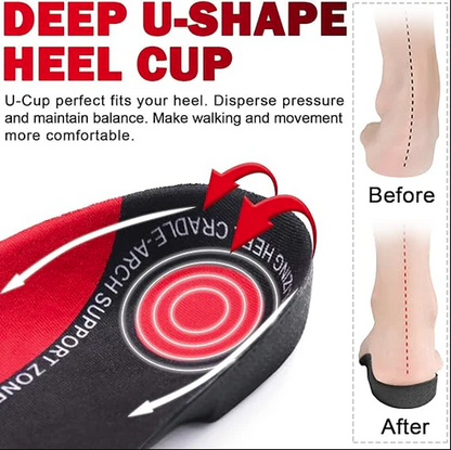High Arch Support